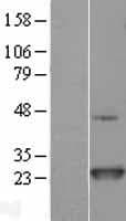 Human NRAS / N-ras Protein (Over-Expression Lysate Myc-DDK (Flag))