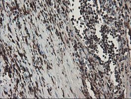 F13A1 / Factor XIIIa Antibody (clone 6F5, Carrier-free)