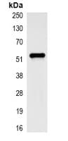 PathPlus™ Monoclonal Mouse anti-Human KRT7 / CK7 / Cytokeratin 7 Antibody (IHC, WB)