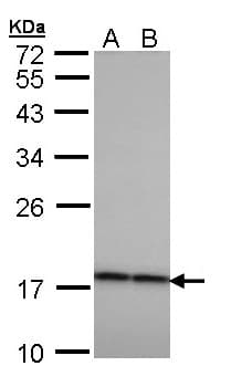 CRYBA4 Antibody (aa1-196)