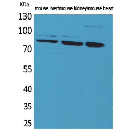 Polyclonal Rabbit anti-Human Cullin 4B / CUL4B Antibody (Internal, WB)