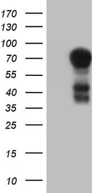 MSLN / Mesothelin Antibody (aa270-493, clone OTI4H6)