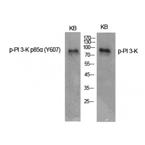 PIK3R1 / p85 Alpha Antibody (550-630 aa)
