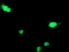 DCK / Deoxycytidine kinase Antibody (clone OTI15E12)