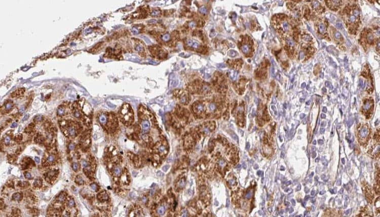 ACTRIIB / ACVR2B Antibody