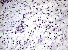NBN / Nibrin Antibody (clone OTI6E11)