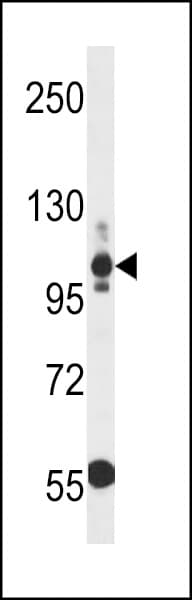 Polyclonal Rabbit anti-Human THBS3 / Thrombospondin 3 Antibody (aa227-255, WB)