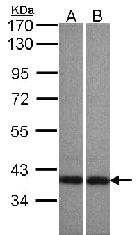 ADAP1 / CENTA1 Antibody (aa312-374)