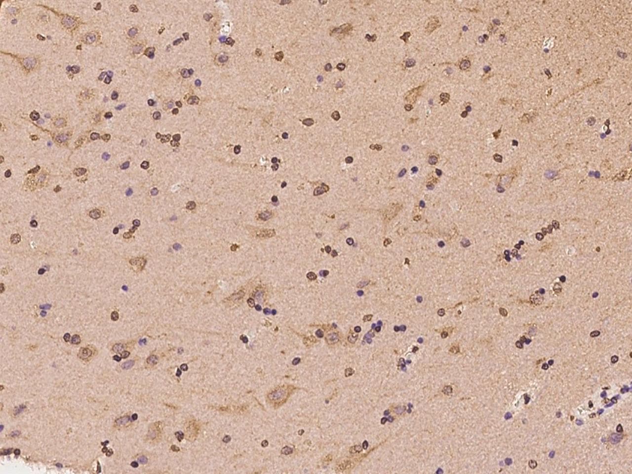 Polyclonal Rabbit anti-Human DYNC1I1 Antibody (IHC)