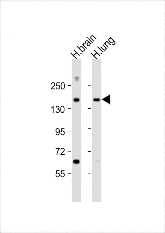 Polyclonal Rabbit anti-Human MTUS1 Antibody (aa183-226, WB)