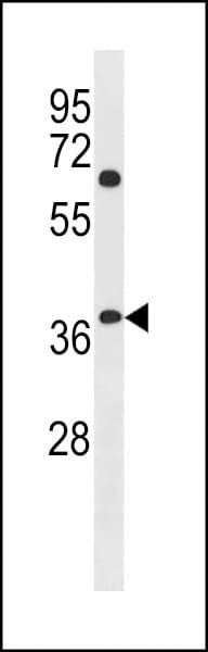 Polyclonal Rabbit anti-Human NHLRC3 Antibody (aa216-245, WB)