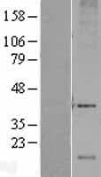 DRAM1 / DRAM Protein (Over-Expression Lysate Myc-DDK (Flag))