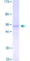 Human FGF23 Protein (Recombinant GST)