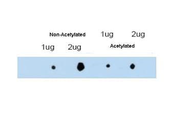 TRIM29 Antibody (Lys116, Internal)