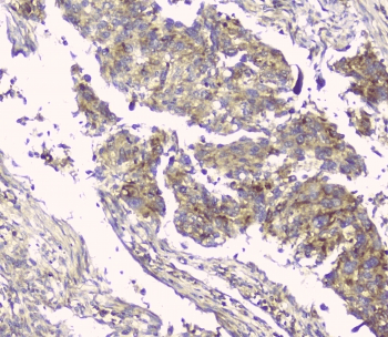 HAS1 / HAS Antibody