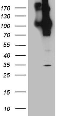 APBB1 / FE65 Antibody (clone OTI1G6)