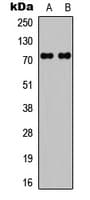 Polyclonal Rabbit anti-Human RAF1 / RAF Antibody (N-Terminus, IHC, WB)