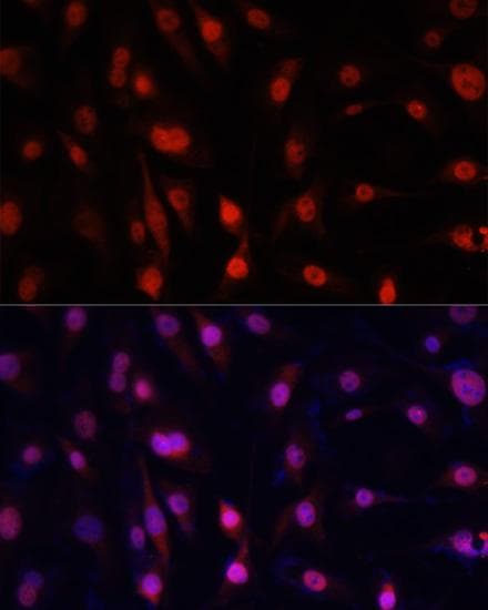 YBX1 / YB1 Antibody