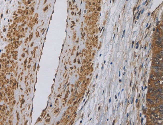 Dynactin 3 / DCTN3 Antibody