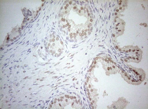 AR / Androgen Receptor Antibody (aa420-659, clone OTI3C5)