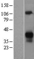 ASGR2 Protein (Over-Expression Lysate Myc-DDK (Flag))
