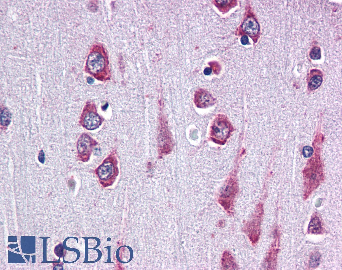 IHC-plus™ RAPSN Antibody (aa399-412)