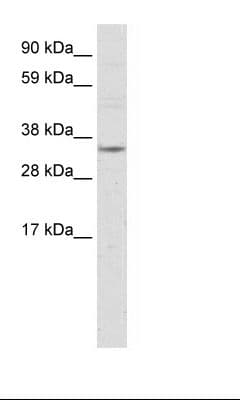 NR1I3 / CAR Antibody (aa121-170)