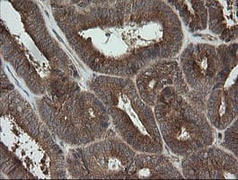 Monoclonal Mouse anti-Human TRAPPC4 / Synbindin Antibody (clone OTI2G8, IHC, WB)