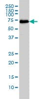 CDK5RAP3 Antibody (clone 1G4)