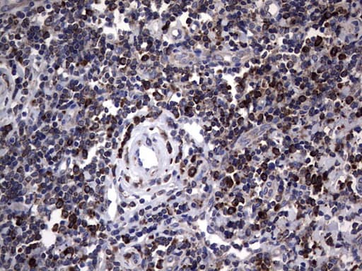 MTDH / Metadherin Antibody (aa70-582, clone OTI1B6)