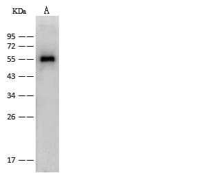 Polyclonal Rabbit anti-Influenza A Virus Influenza A Virus Nucleoprotein Antibody (Preservative Free, IHC, IF, WB)