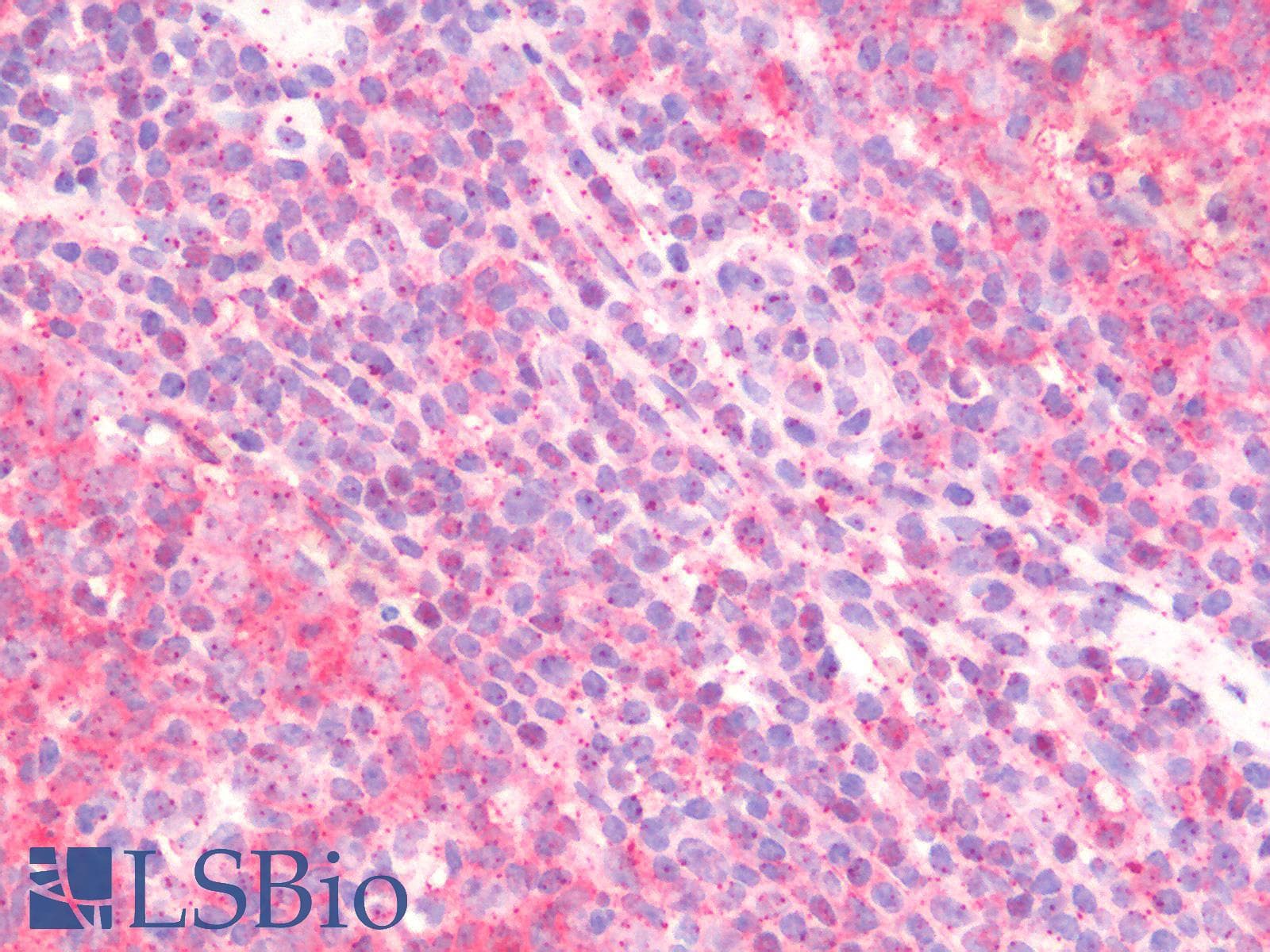 IHC-plus™ Polyclonal Rabbit anti-Human ITGA4 / VLA-4 / CD49d Antibody (C-Terminus, IHC)