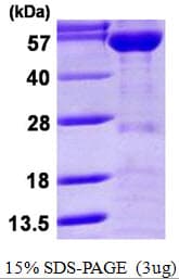 Human KPNA2 / Importin Alpha 1 Protein (Recombinant His)
