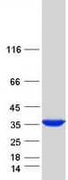 Human SULT1C2 / Sulfotransferase 1C2 Protein (Recombinant Myc-DDK (Flag))