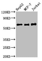 Polyclonal Rabbit anti-Human PRUNE Antibody (IHC)