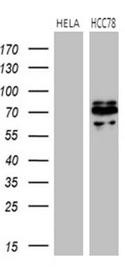 ROS1 / ROS Antibody (aa1882-2125, clone OTI1A1, Carrier-free)