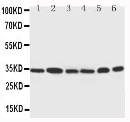 CDK4 Antibody (N-Terminus)
