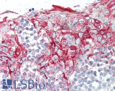 SPINK5 / LEKTI Antibody (aa699-976)