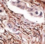 NOTCH3 Antibody (aa2291-2321)