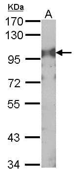 IHC-plus™ Polyclonal Rabbit anti-Human CD71 / Transferrin Receptor Antibody (IHC, WB)