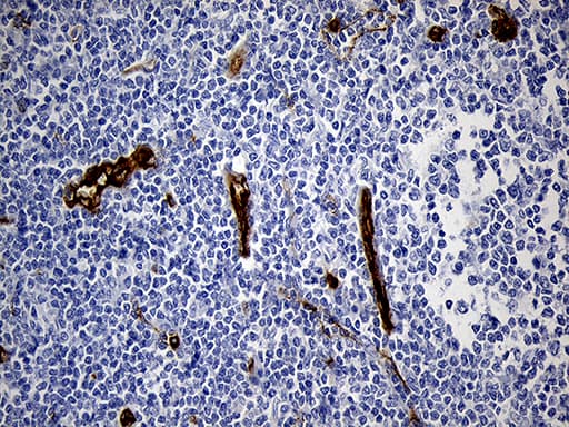 Monoclonal Mouse anti-Human TSPAN7 / CD231 Antibody (clone OTI2D6, IHC, WB)