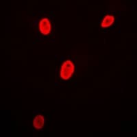 Polyclonal Rabbit anti-Human POU6F1 / BRN5 Antibody (IF, WB)