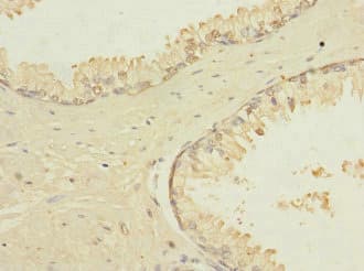 Polyclonal Rabbit anti-Human TRPM4 Antibody (IHC)