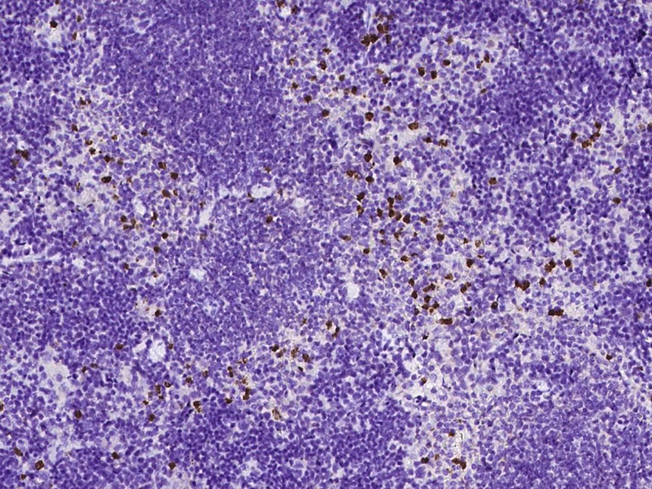 MMP8 Antibody