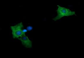 MAP2K2 / MKK2 / MEK2 Antibody (clone OTI1A2)