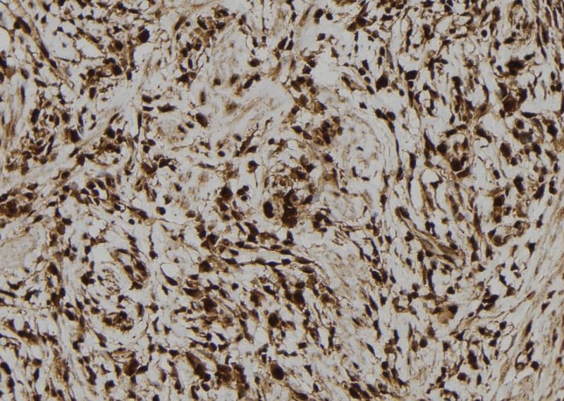 LMO7 Antibody