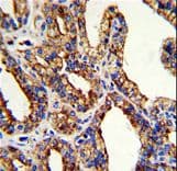 Polyclonal Rabbit anti-Human TROP2 / TACSTD2 Antibody (aa162-190, IHC, WB)