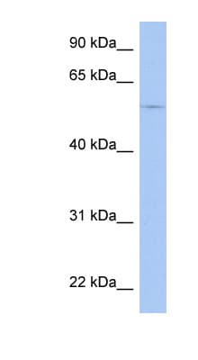 Polyclonal Rabbit anti-Human BIA2 / TRIM58 Antibody (C-Terminus, WB)