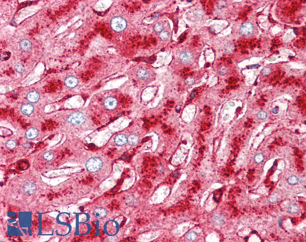 PathPlus™ Melanoma-Associated Antigen Antibody (clone NKI-C3)