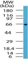 IHC-plus™ Polyclonal Rabbit anti-Human RELA / NFKB p65 Antibody (IHC, WB)